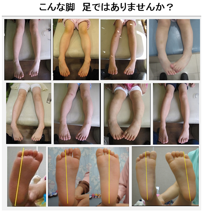 脚足事例.png